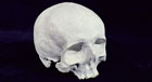 Cast of Haydn's cranium